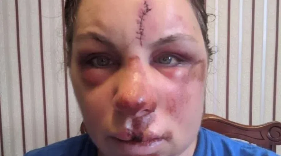 Online Fundraiser For Injured Saint John Woman