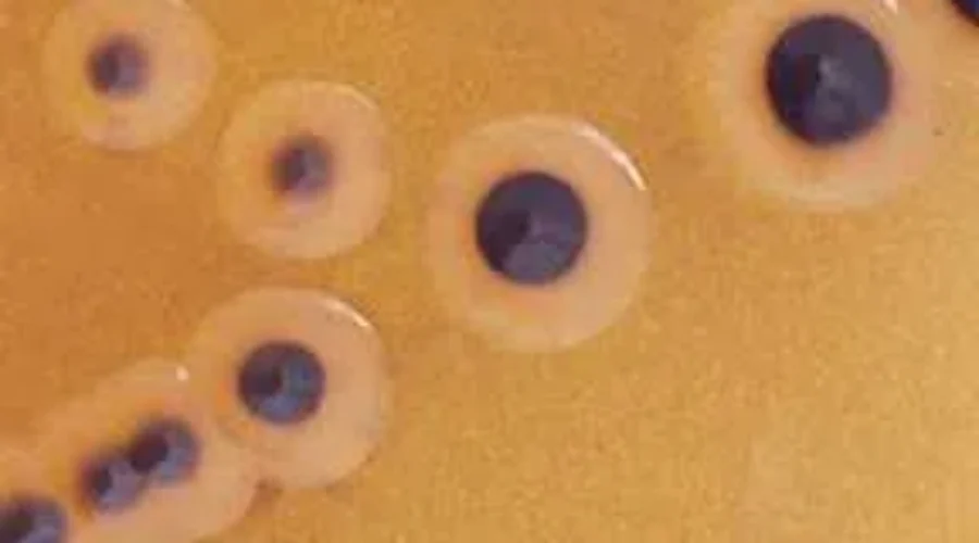 Outbreak of drug-resistant salmonella infections found in Canada: Public Health