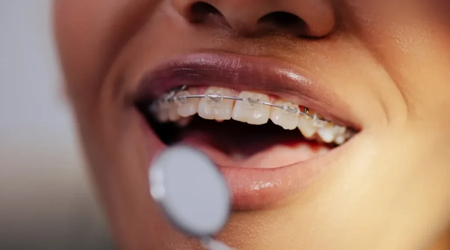 Patients scramble after Quispamsis orthodontist closes